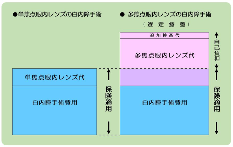 多焦点眼内レンズを使用する白内障手術と「選定療養」